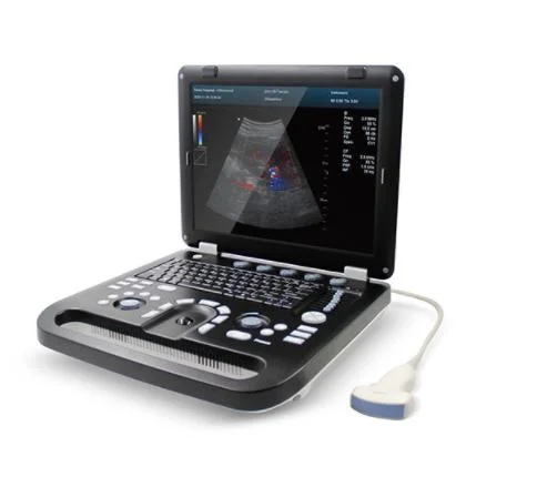 Cms1700b Portable Color Doppler Machine Hospital Ultrasound Scanner