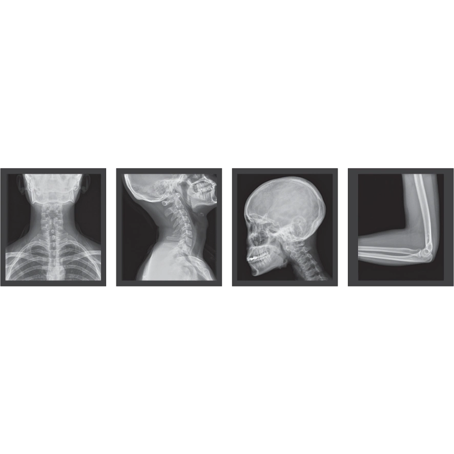 Digieye 280 équipement médical 50kw 630mA système de radiographie numérique médical