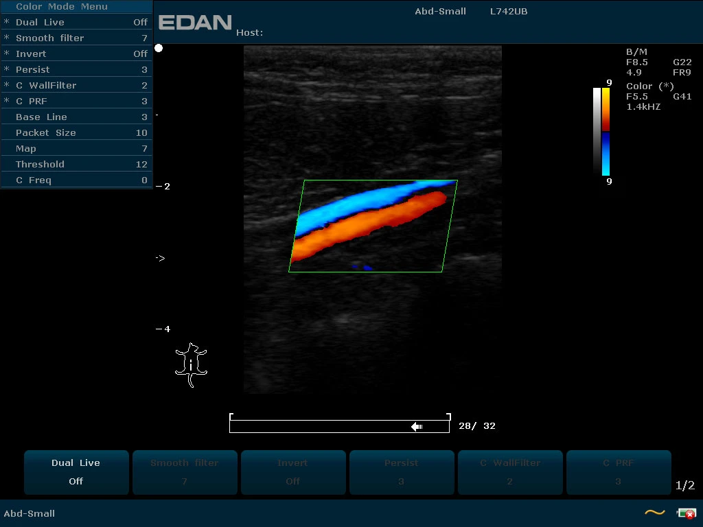 Edan U2 Veterinary Trolley Ultrasound Machine con Convex/Linear/Transvaginal Transducer