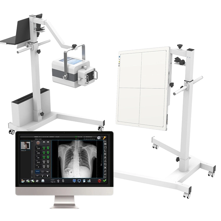 Digitaler drahtloser Flachdetektor mit Software und Röntgenstrahlung Maschine Iray Mars 1417V Preis DR Cr System Radiologie Ausrüstung Und Zubehör