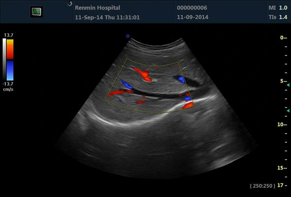 2023 High quality/High cost performance 15 Inch Trolley LCD Color Doppler Ultrasound Scanner