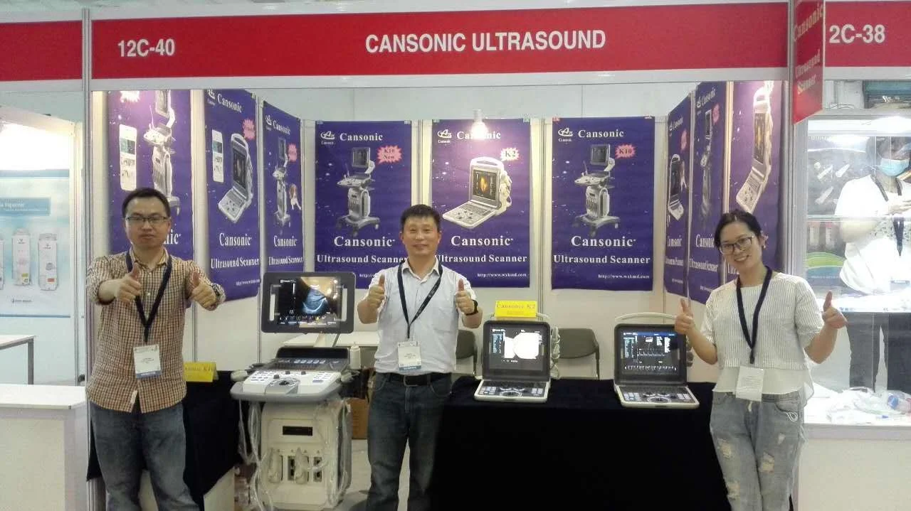 Competitive Price and Quality Ultrasound Scanner