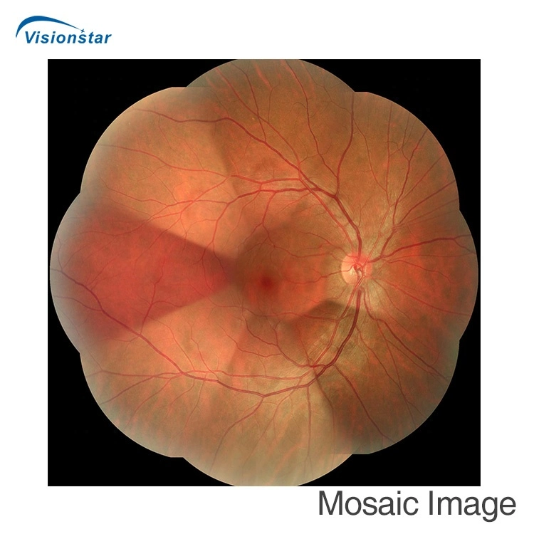 With FAF Function Non-Mydriatic Auto Focus Reticam 3100 Retinal Fundus Camera