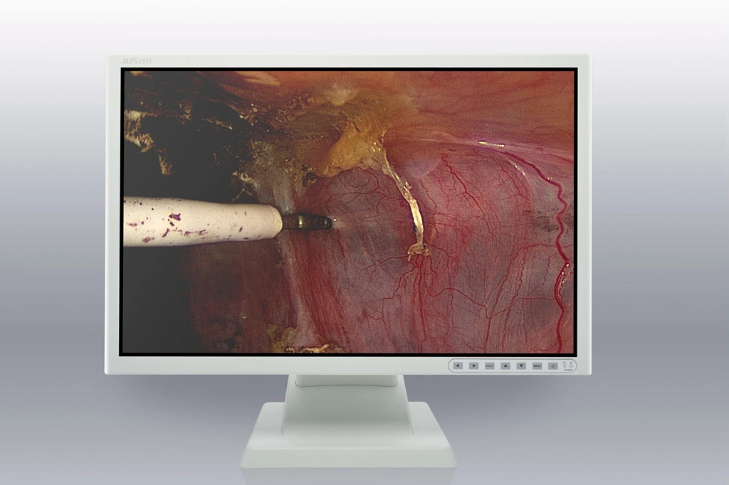 (JUSHA-ES26P) 26 Inch Endoscopic & Surgical Medical Display