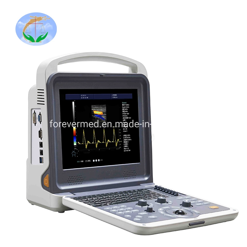 Best Price Portable Color Doppler Ultrasound