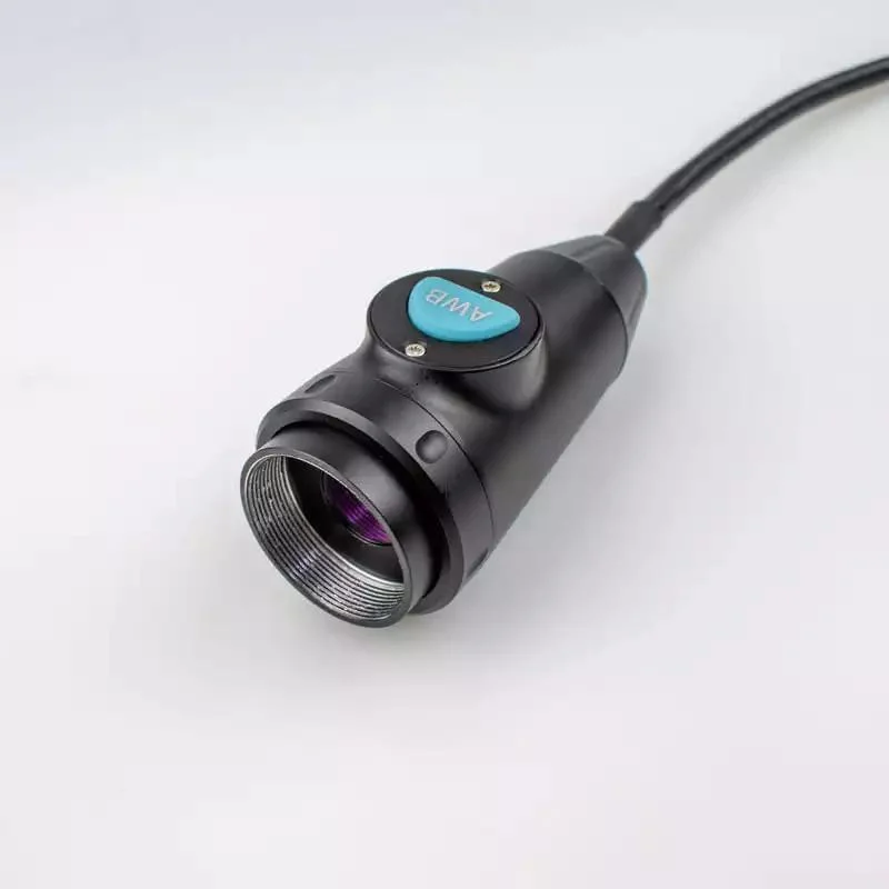 Full HD Endoscope caméra USB portable ent Meidical Ensemble diagnostic