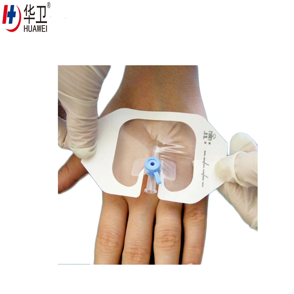 Medical Supplier Surgical Wound Care IV Cannula Fixing Dressing