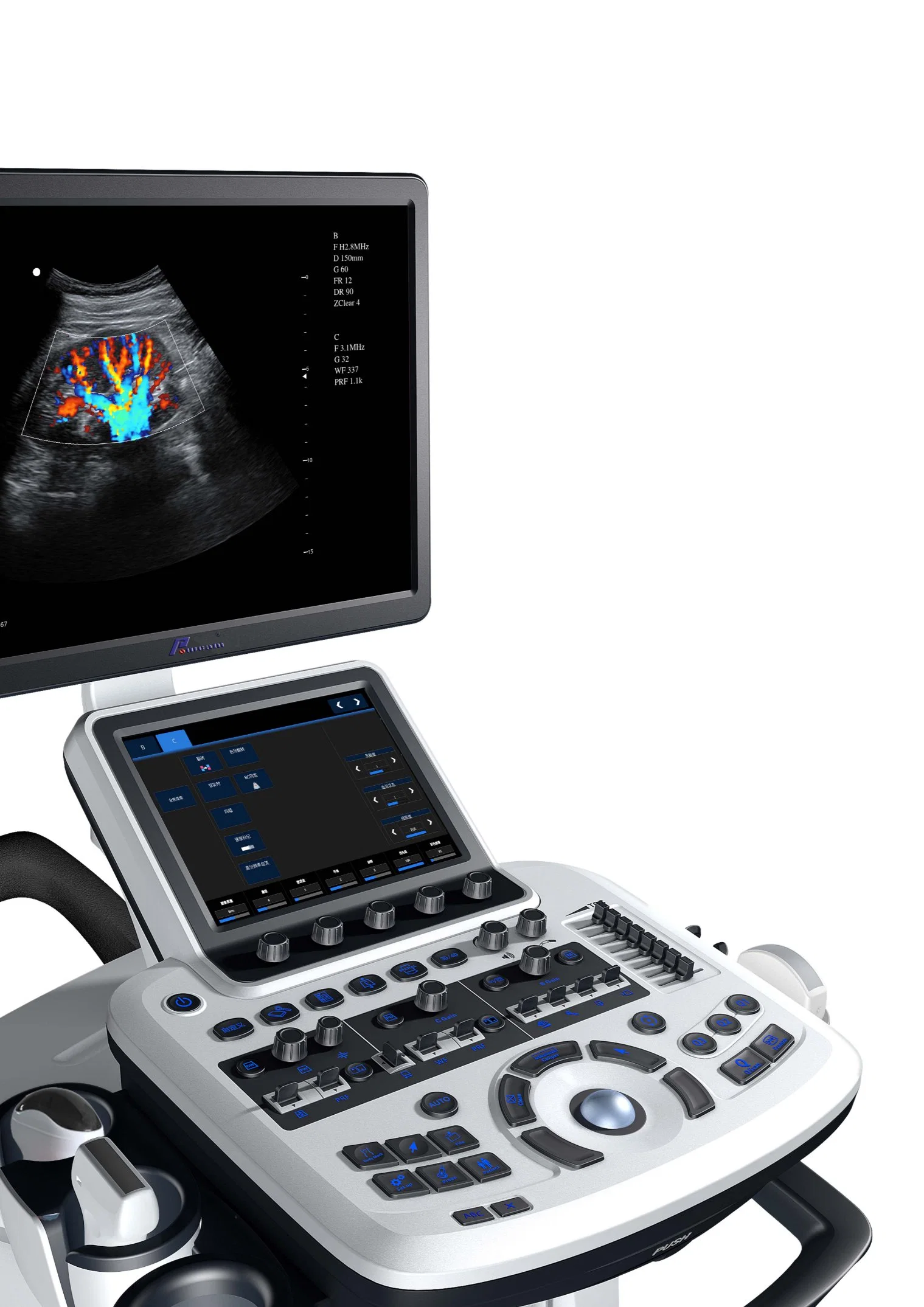 Full-Digital Color Doppler Ultrasound Diagnostic System