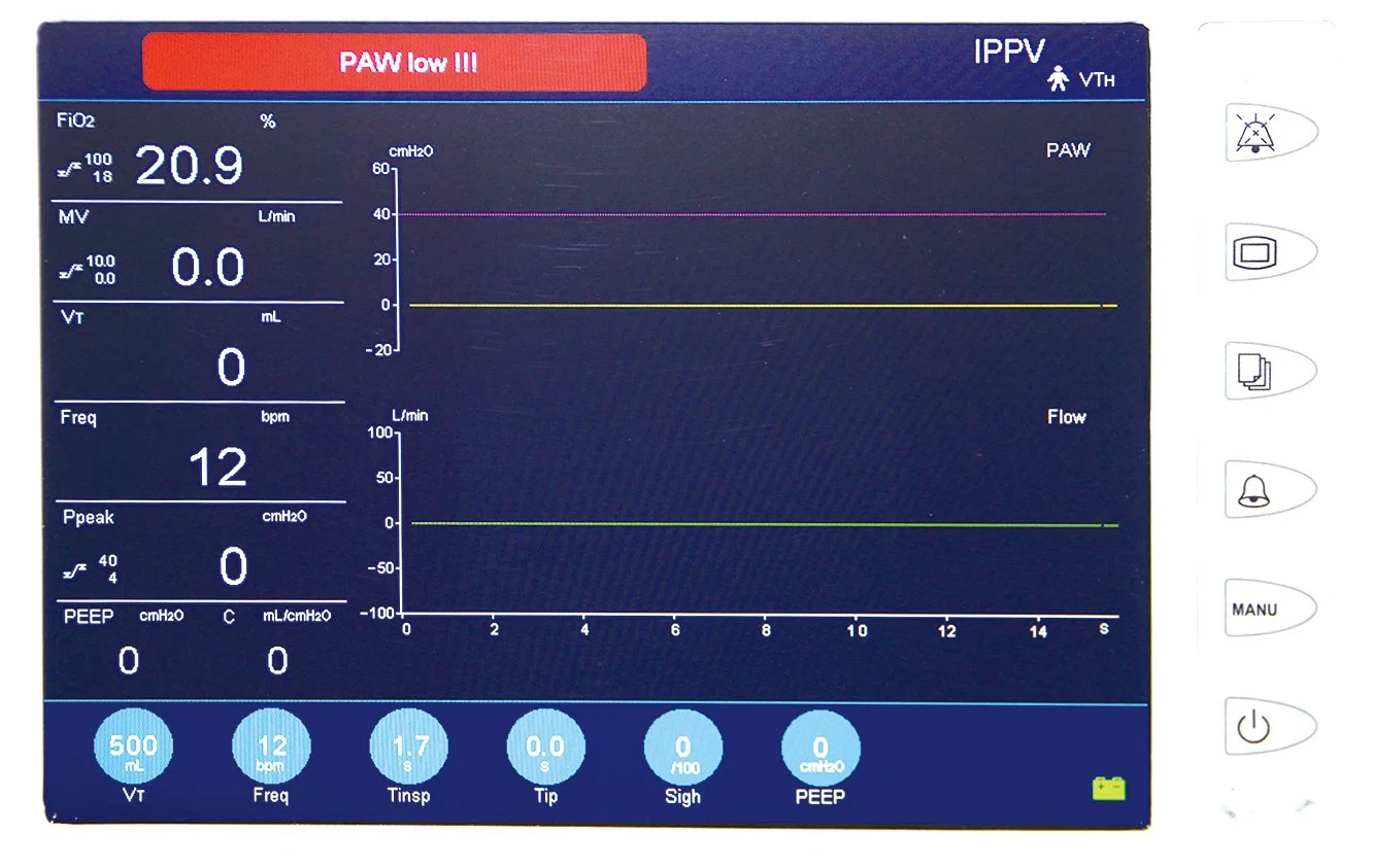 15"Colorful TFT LCD Touch Screen Hospital Surgical Equipment ICU Ventilator Medical Equipment