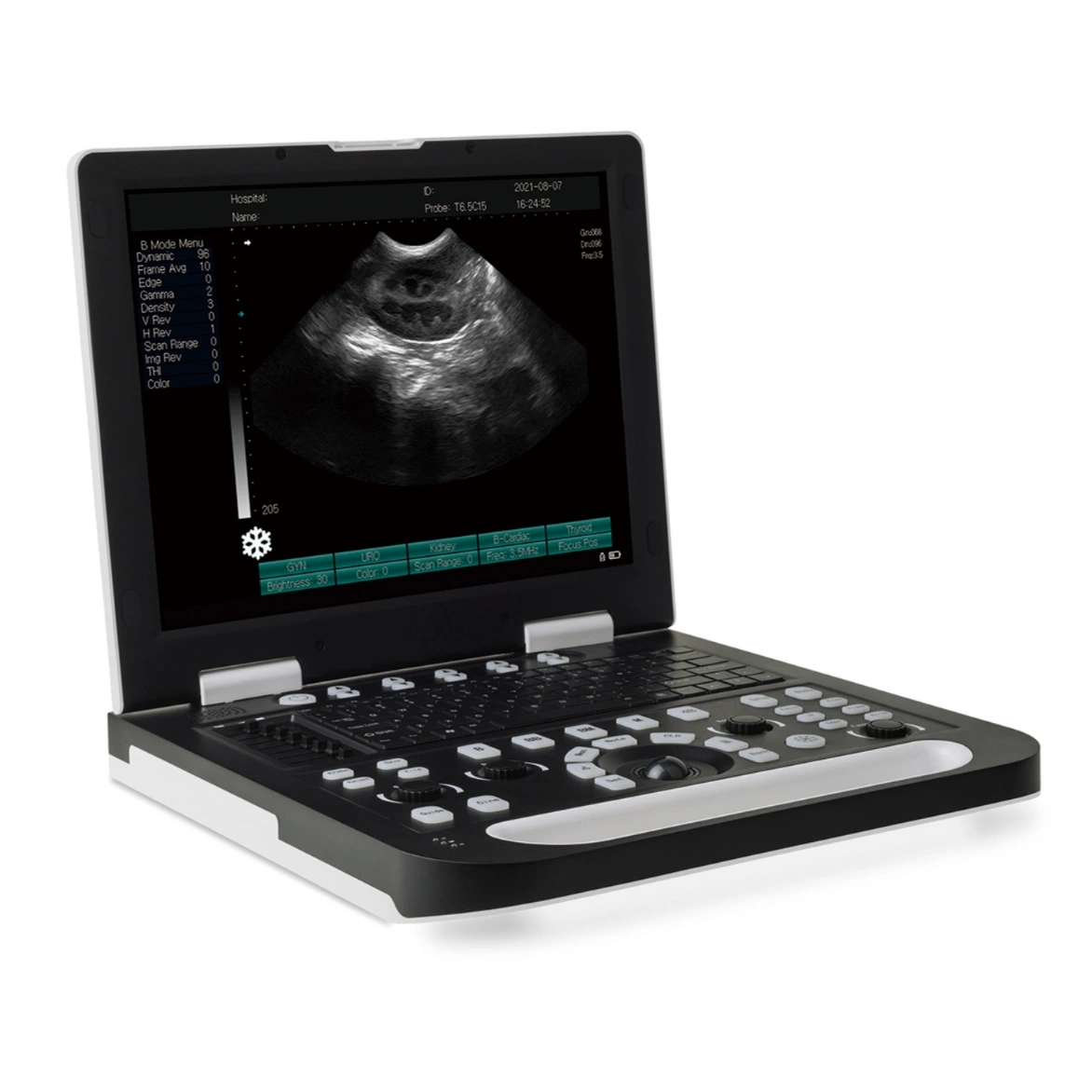 معدات التشخيص الطبي في المستشفى جهاز الماسح الضوئي بالأشعة فوق الصوتية بالكمبيوتر المحمول بالأبيض والأسود مع عرض صور عالية الجودة