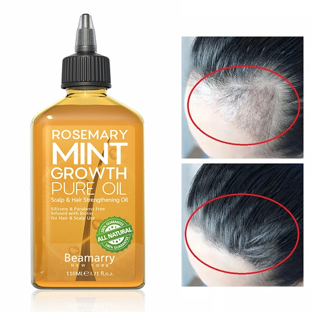 110ml por grosso de Silicone Cosméticos &amp; Parabenos cabelos sem reforço de alecrim Óleo Crescimento Menta óleo puro para o cabelo e o couro cabeludo usar