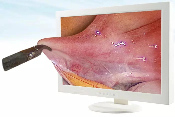 3D HD Endoscopie Camera System for The General Surgery