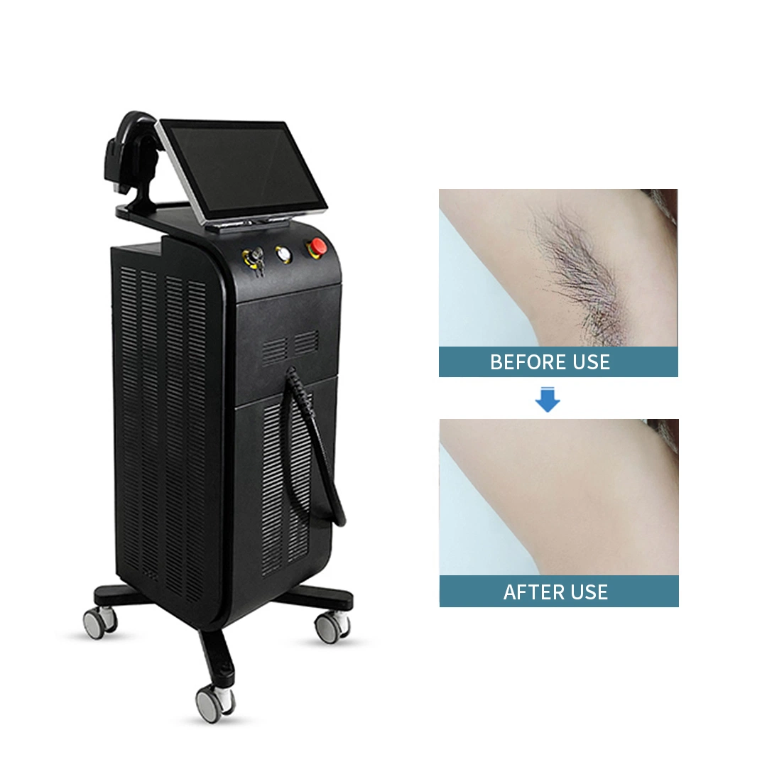 3 Wavelengths Permanent Portable 808 Nm Diode Laser Hair Removal Medical Euipmemt