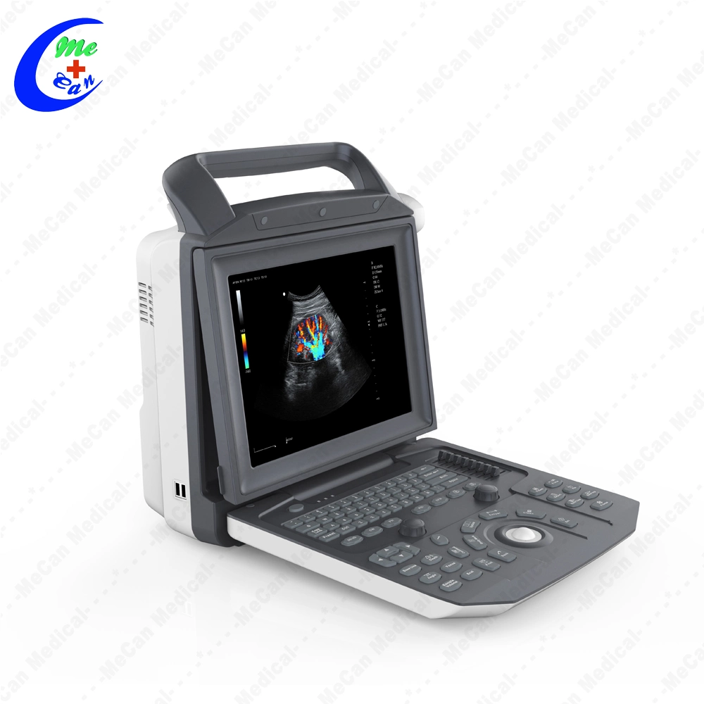 Medical Portable 3D Ultrasound Color Doppler Ultrasound Scanner