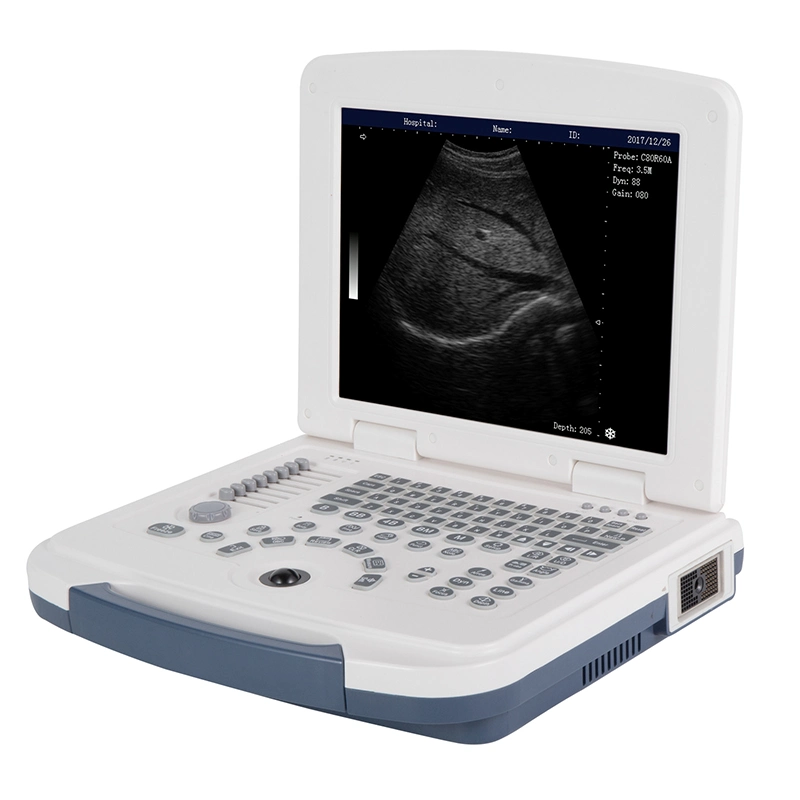 B/W Mecanmed Device Laptop Doppler Scanner Portable Ultrasound Machine with Cheap Price