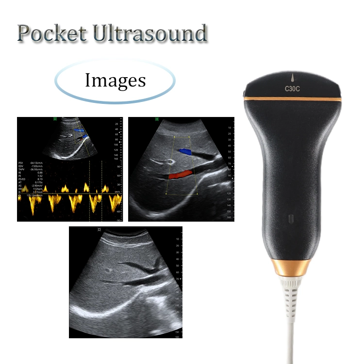 Original Factory fabrica Pocket Ultrasound Scanner 128 Elements Portable USB Sonda máquina ultrasónica