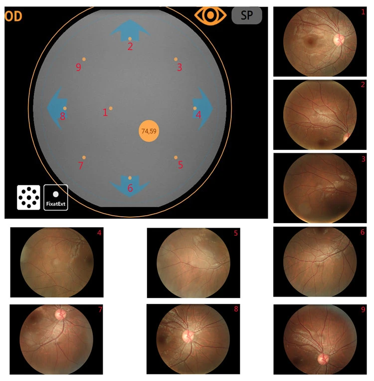 My-V036b Auto Detected The Eye Position Fundus Camera Digital Fundus Photography Retina Camera Price for Ophthalmology