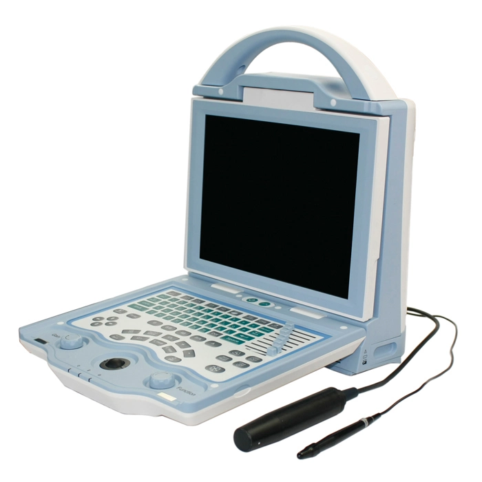 CAS-2000d China Ophthalmic Equipment Ophthalmology Ultrasound Ab Scanner a B Scan with Built-in Computer