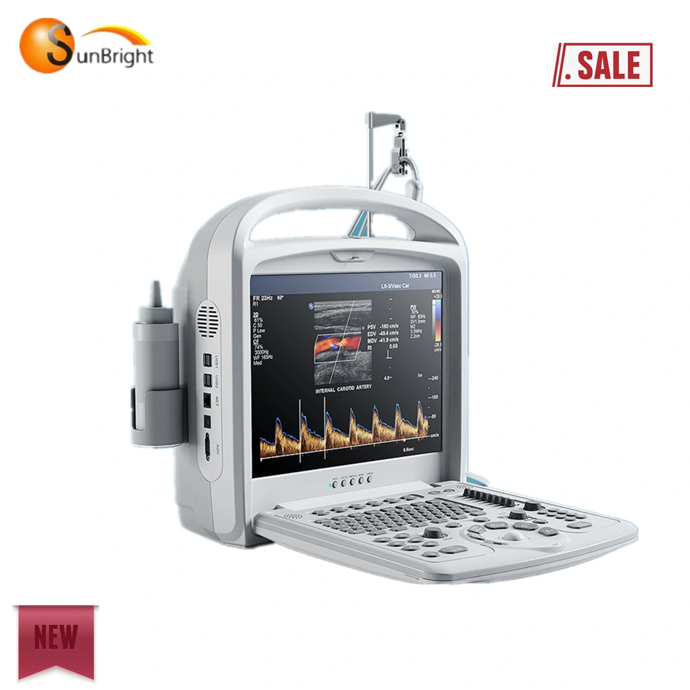 Система Windows для цветовой допплеровской ультразвуковой системы Sunbright 2D Ultrasound Machine Color Doppler Ultr