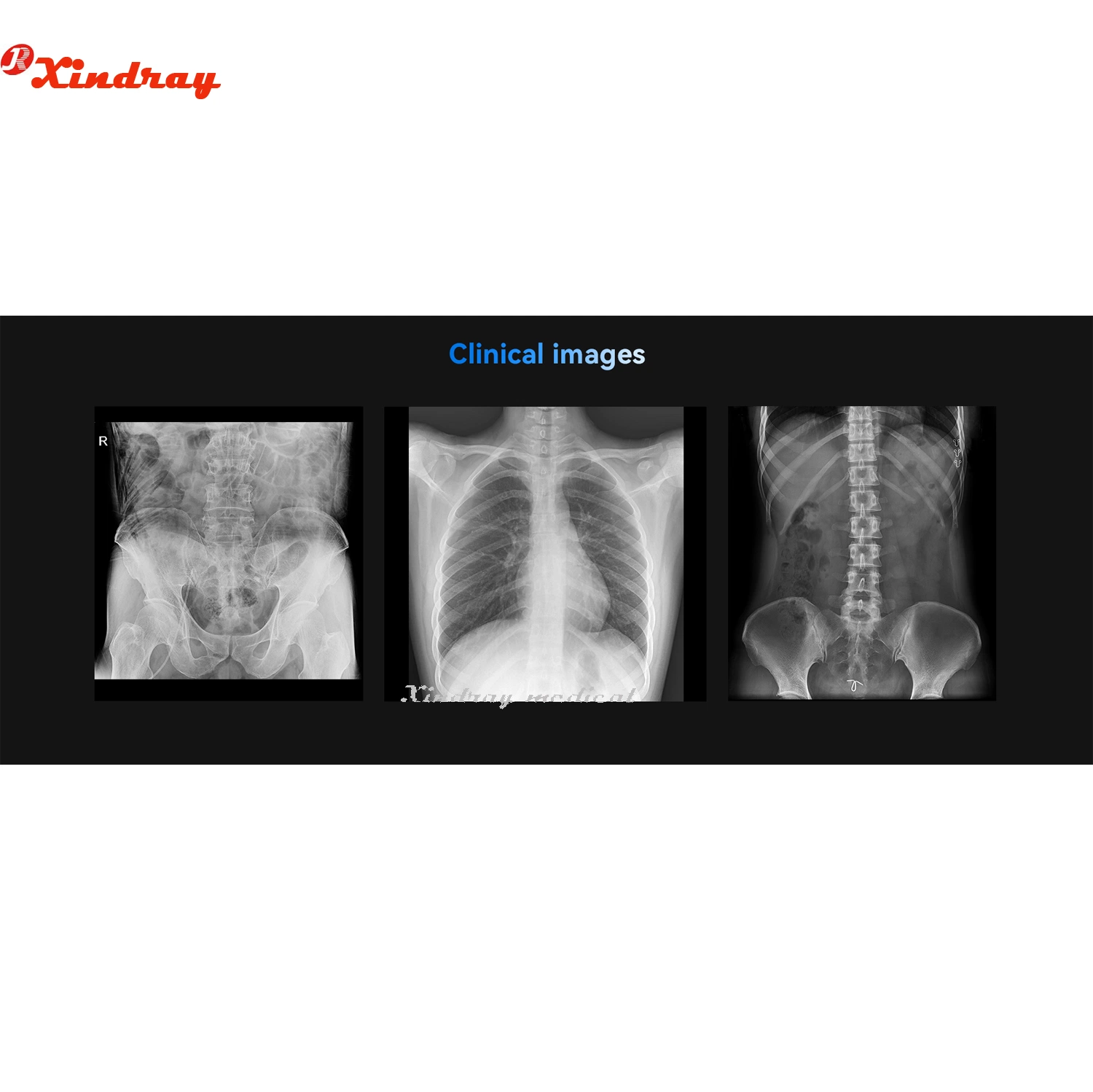 Hospital X-ray Radiography Machine Convenient Operation for Outdoor