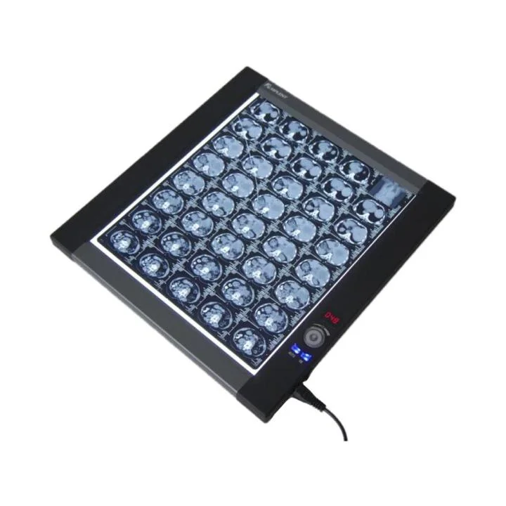 LED Medical XRay Film Viewer / XRay Film Illuminator Medical معدات الأشعة السينية والملحقات من الفئة I