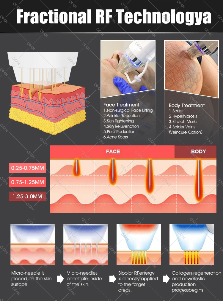 Professional Microneedle/RF RF mejor cara de apriete de la piel de la máquina de elevación/ radiofrecuencia fraccionada Micro aguja