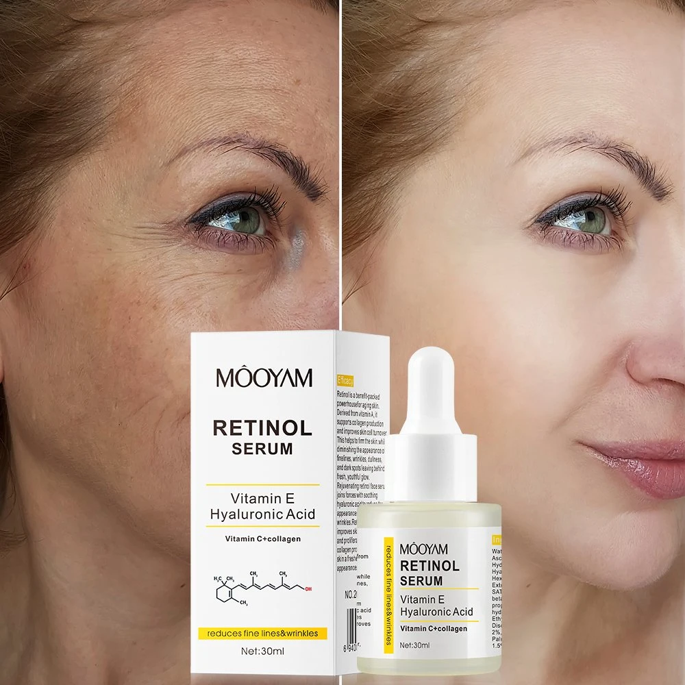 Частная этикетка, OEM Retinol с гиалуроновой кислотой Vetamin E лица Сыворотка эффективно разглаживает морщины восстанавливающая антисстареющей сыворотке