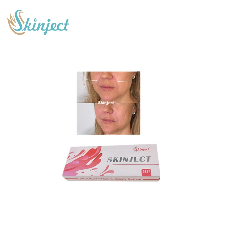 Skinject 2ml Hyaluronic Acid Injection Dermal Filler Gel for Personal Care