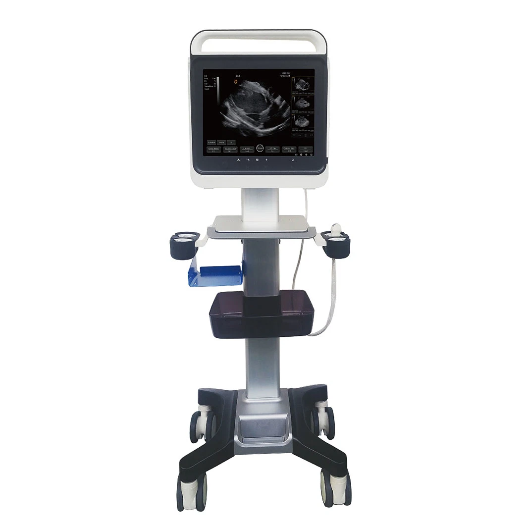 High Definition Image Digital Portable Ultrasound Scan Machine for Human Animals