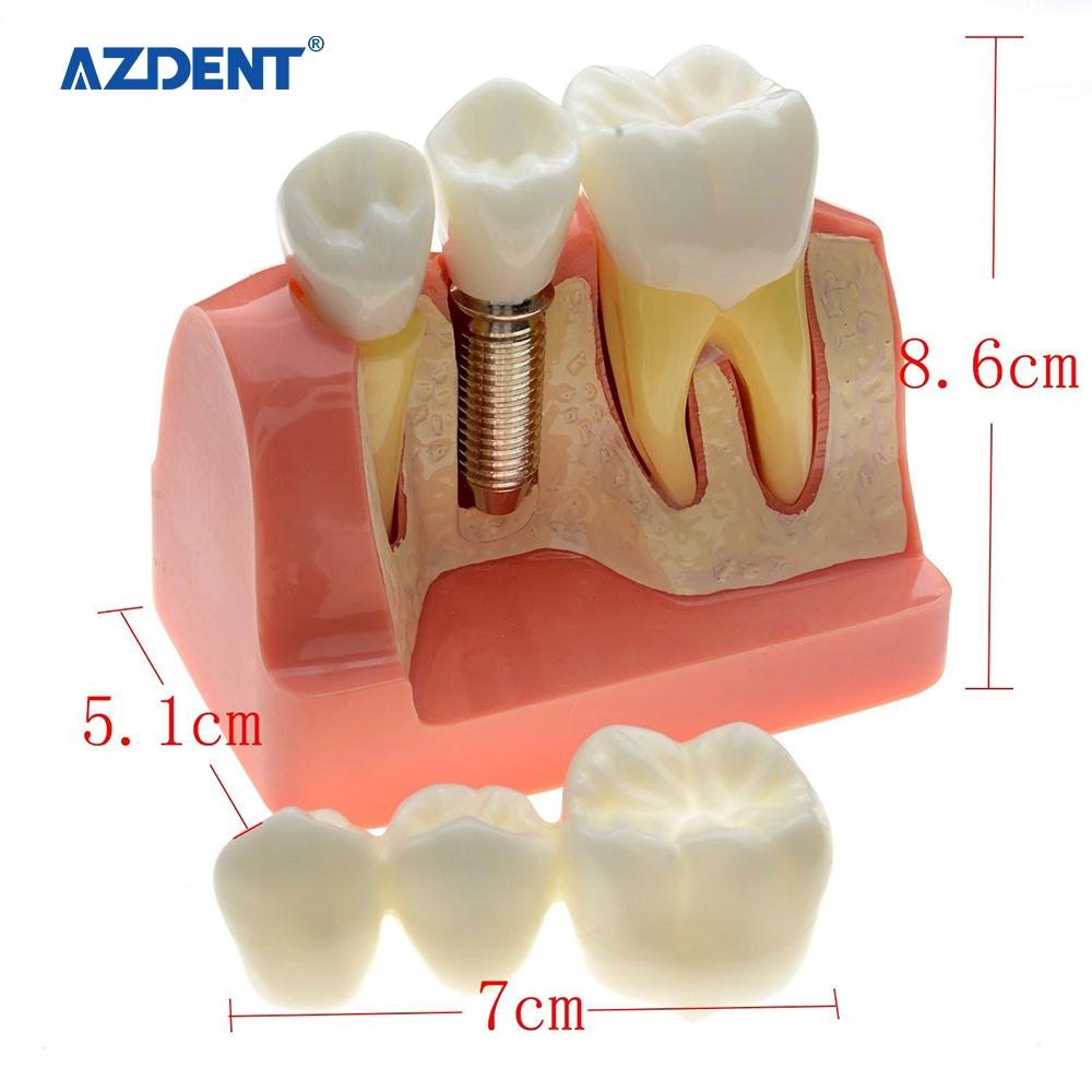 Ce Certified Resin Dental Teeth Model for Sale