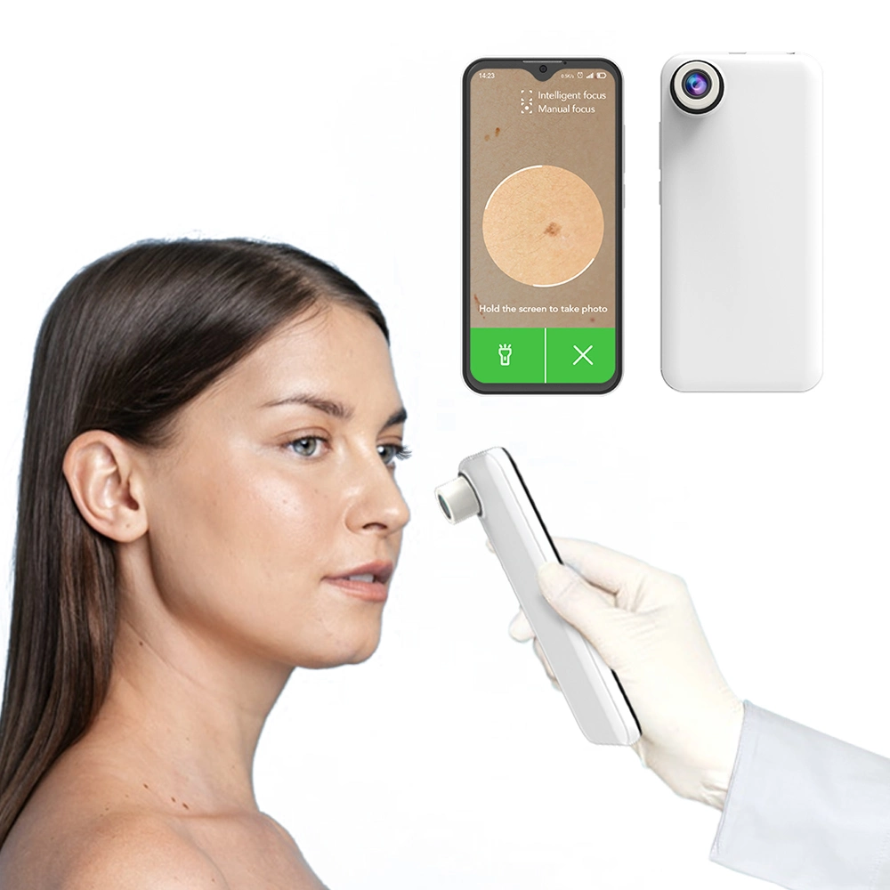 Aparelho de teste de pele com IA de Pixel elevado para o cabelo Analisador de pele de cabelo Scanner cabelo follicle Perm amolecendo o telefone detectando para o cuidado da beleza Salão de beleza