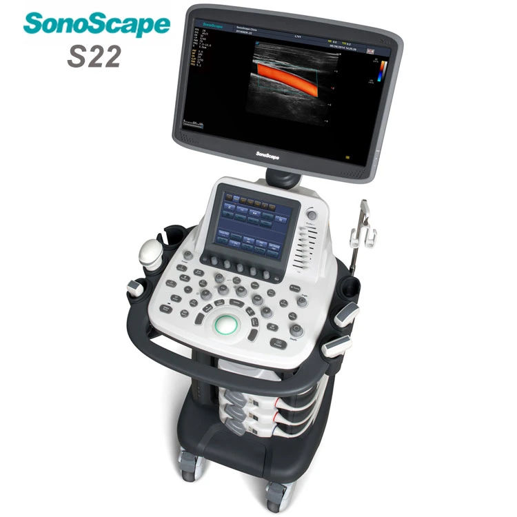 Mobile 4D Trolley Color Doppler Sonoscape S22 Ultrasound System with 8inchtouch Screen 18.5inch LCD