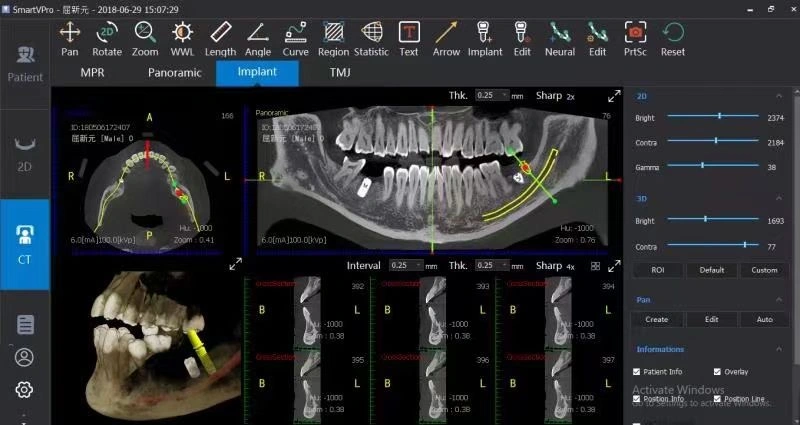 3D Dental Panoramic Xray Machine Cbct Dental X Ray Machine Dental Equipment