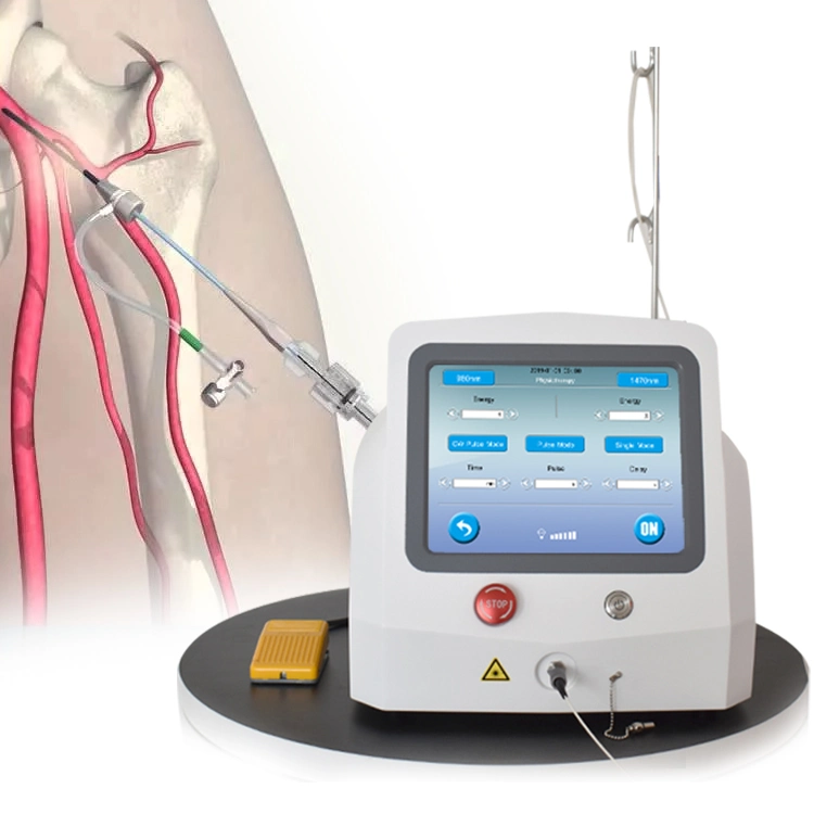 Varizes de alta potência de 30 W Laser Leg EVLT Cirurgia endovenosa Dispositivo laser de díodo de eliminação da veia Aranha de tratamento de 980 nm 1470 nm