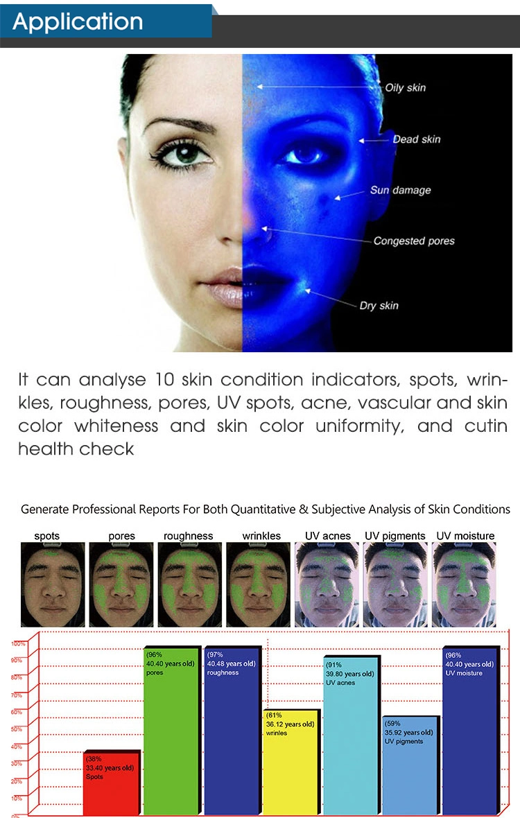 3D más vendidos de la prueba cutánea de la salud enfrentan Visia diagnóstico Análisis de la máquina de análisis de la cara de la máquina