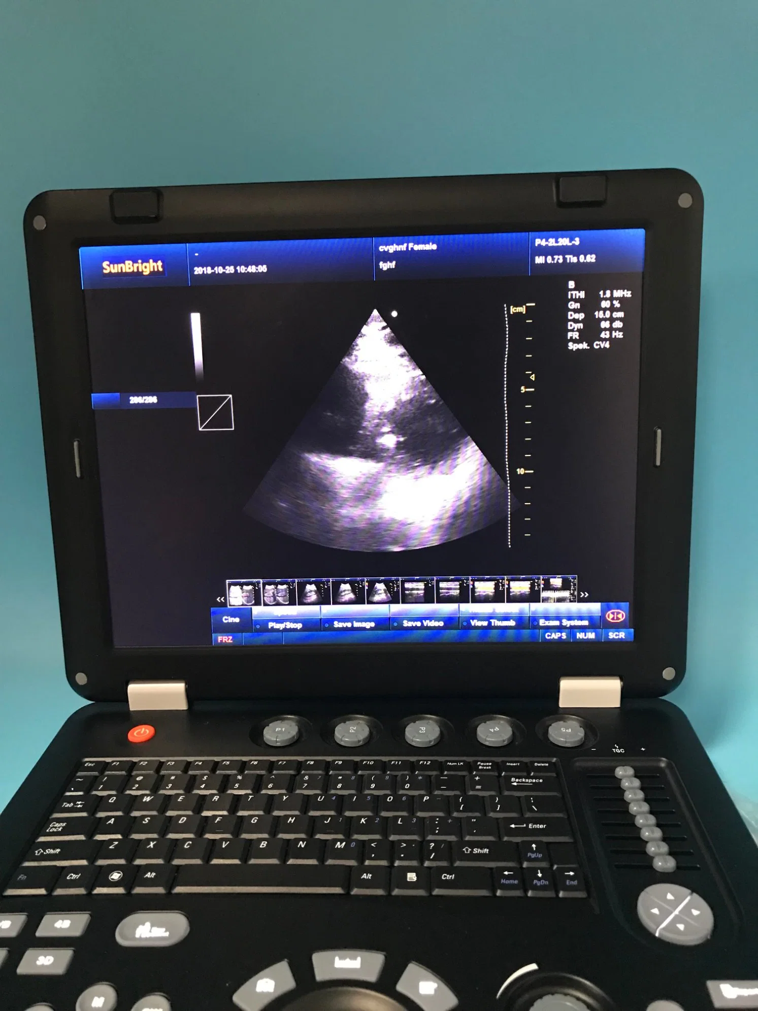 Sun-906b USG Lineat Probe Hospital Colour Doppler 126 Elements Ultrasound