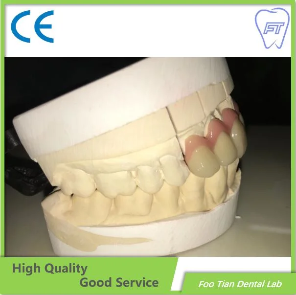 El circonio promocional personalizado de la corona dental Implante Dental de Laboratorio Material completo laboratorio de porcelana de contorno Sin