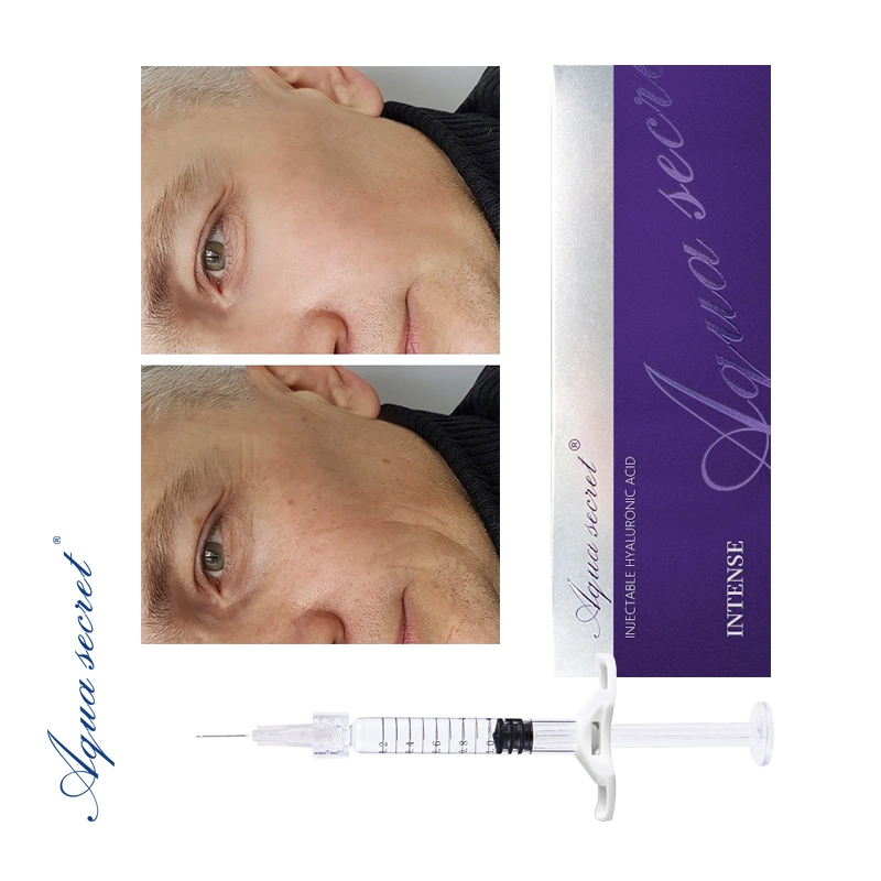 Hyaloronic Acid Dermal Filler Injectable Fillers for The Face Injection