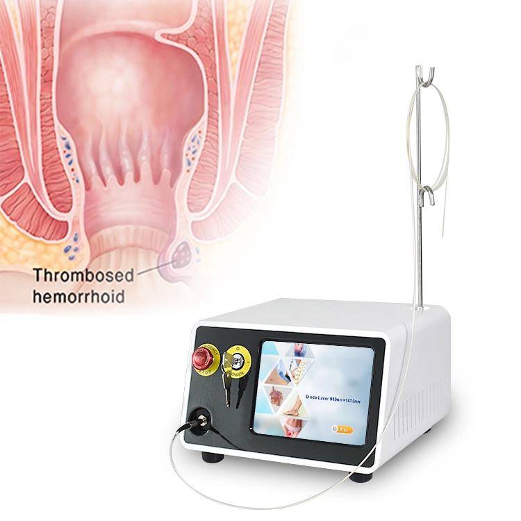 Triangelaser Laseev Proctologie Surgical fistule Anal laser 980 1470 médical Laser