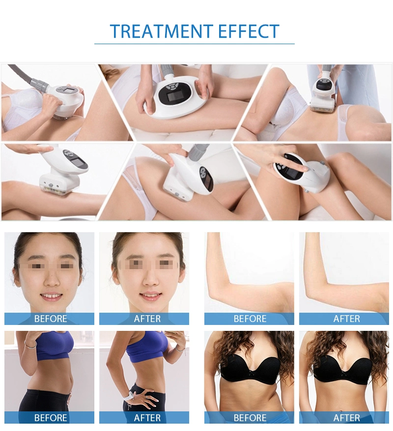 New Professional RF Vacuum Cavitation System Body Slimming Machine