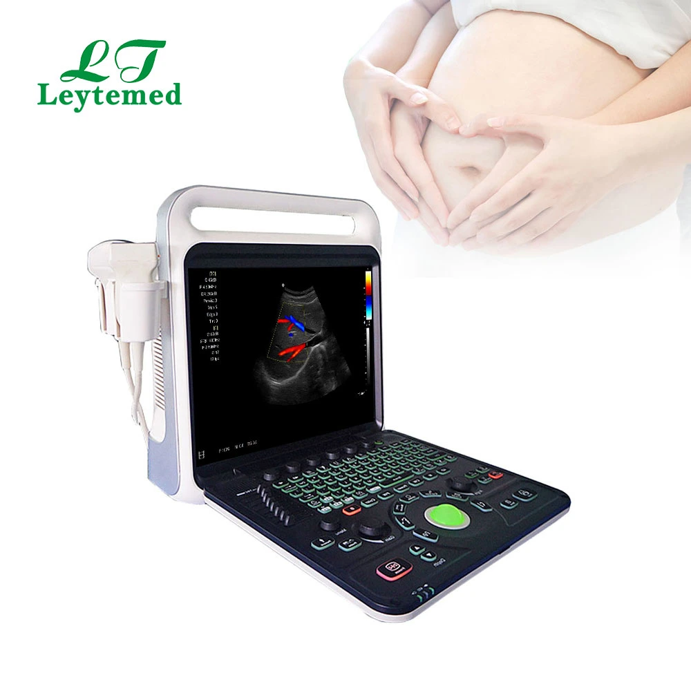 Ltub64 Medical Gynecology Obstetric Full-Digital USB Color Doppler Ultrasound USG