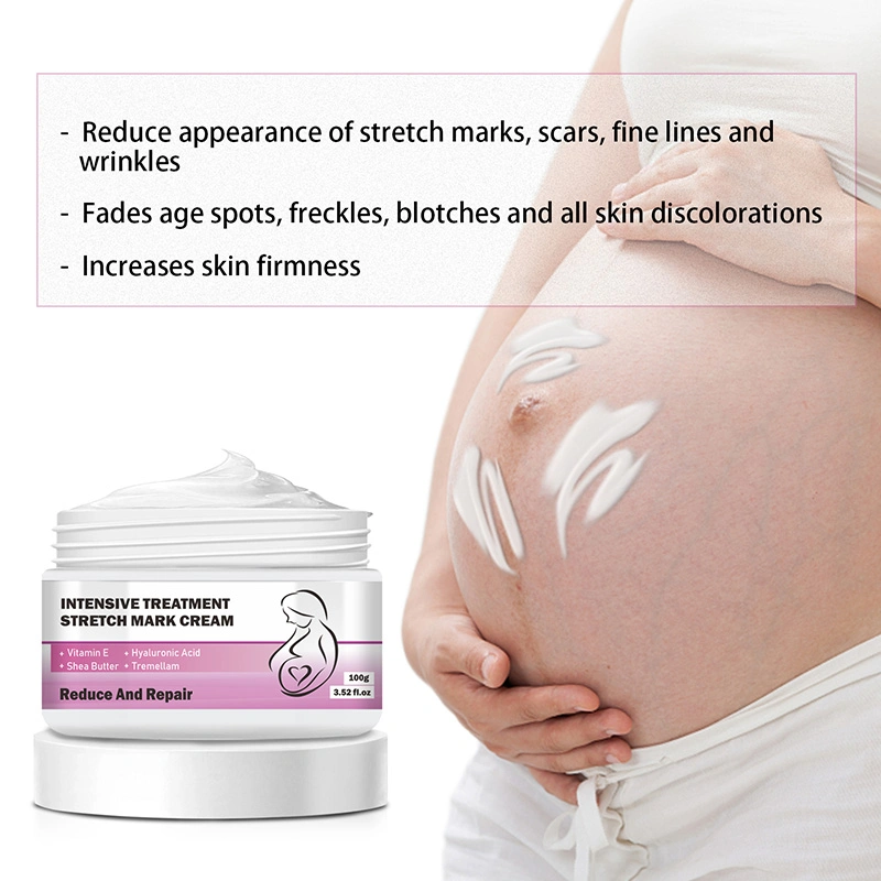 OEM Custom Remove cuerpo Celulitis acné cicatriz Posparto Stretch Mark Removedor Natural Vegan Stretch Mark Cream etiqueta privada