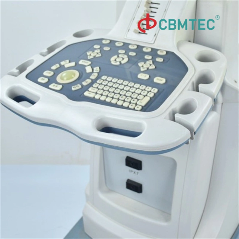 Digital Trolley Ultrasonic Diagnosis Equioment Trolley Ultrasound Scanner