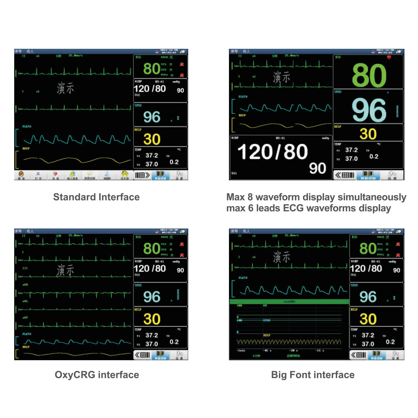 Hm-8000H, de 15 pulgadas portátil Multi-Parameter médicos de la máquina del monitor de paciente