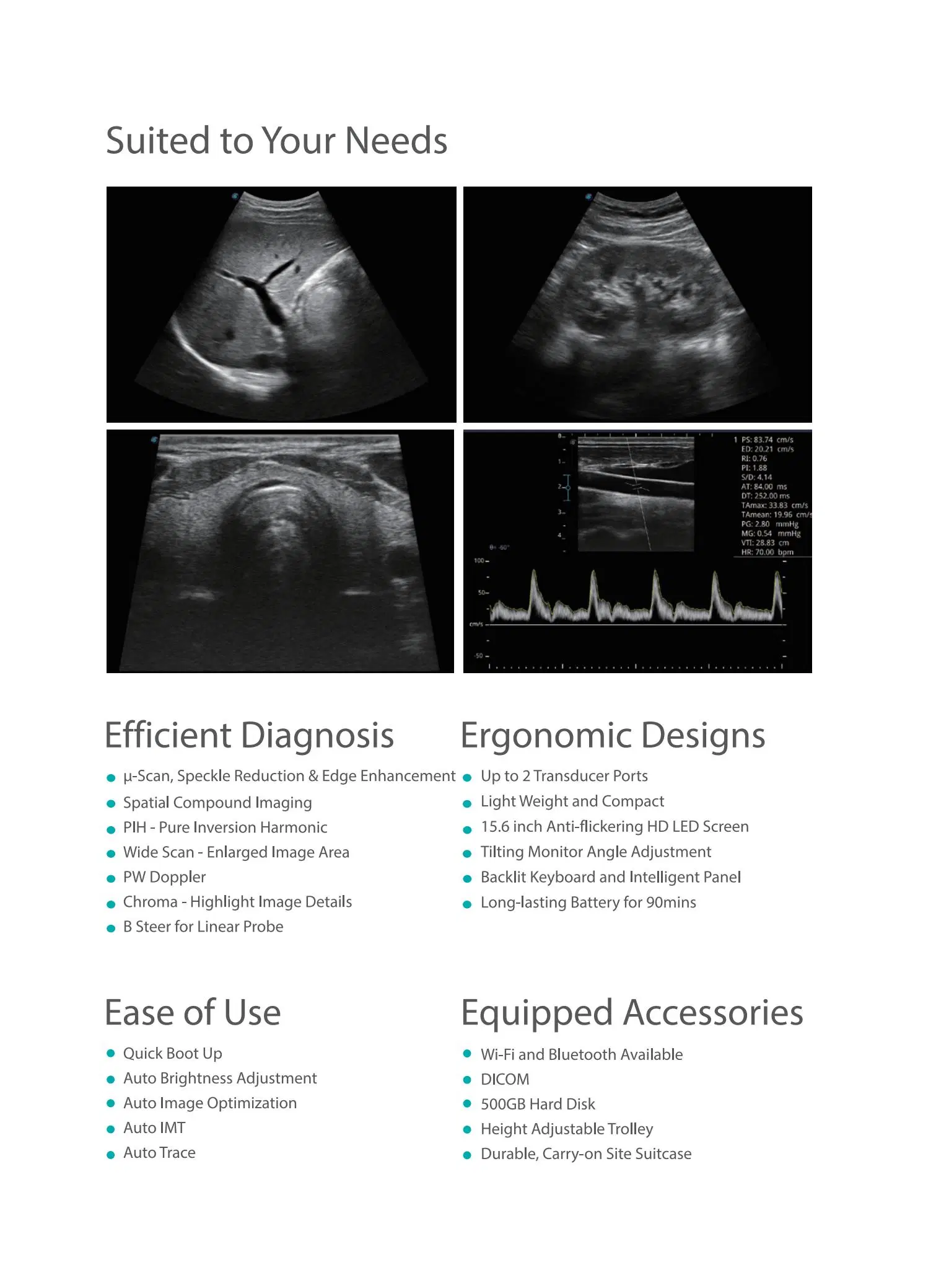 Sonoscape E1 A6 Máquina de Escaneo de Ultrasonido Portátil Máquina de Sonografía Ultra Sound Vet Ultra Minderay Equipos de Suministro de Energía