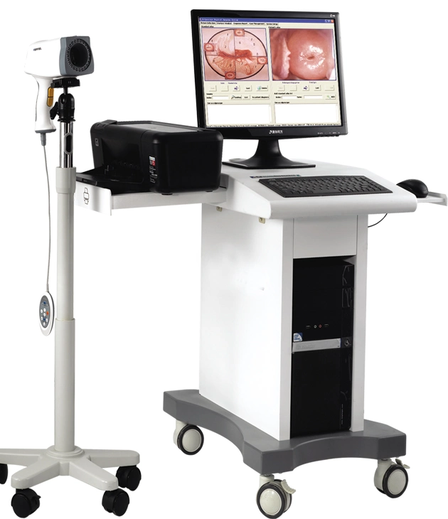 POY-2200 Digital Vagina Diagnosis System Video Colposcope