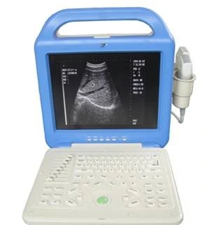 New Portable LCD Display Ultrasound Scanner with a Convex Probe