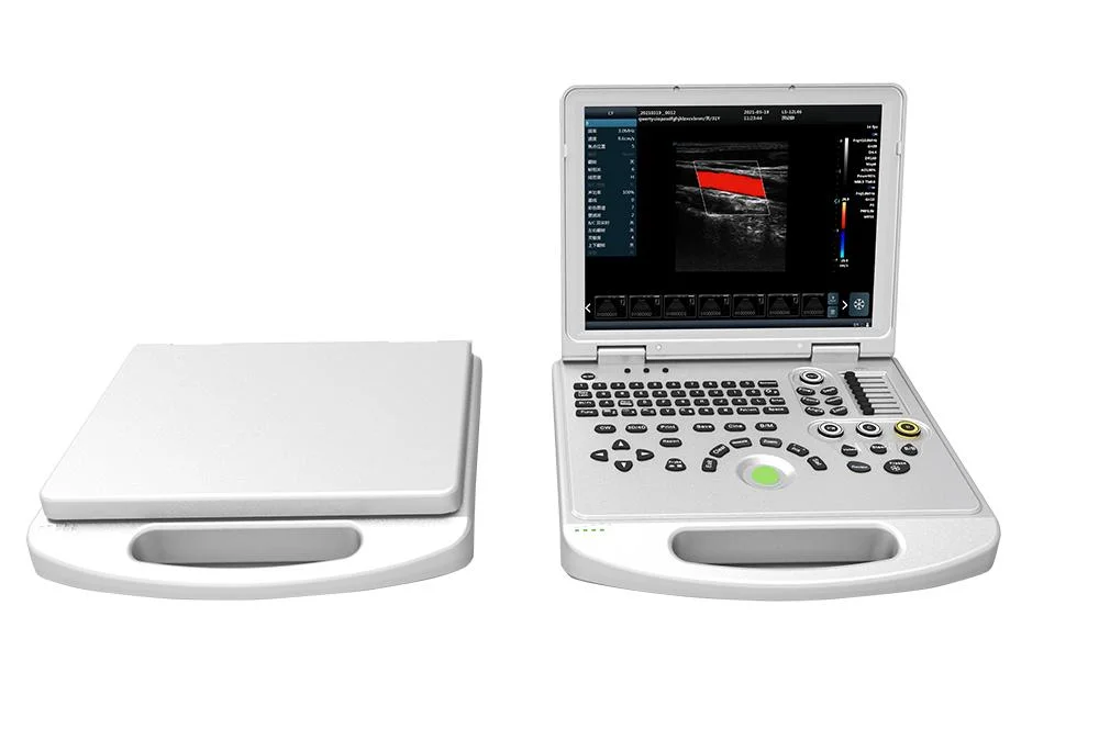 15 Inch LED Medical Display Able to Reverse It Above 160 Degree Portable Ultrasound Machine