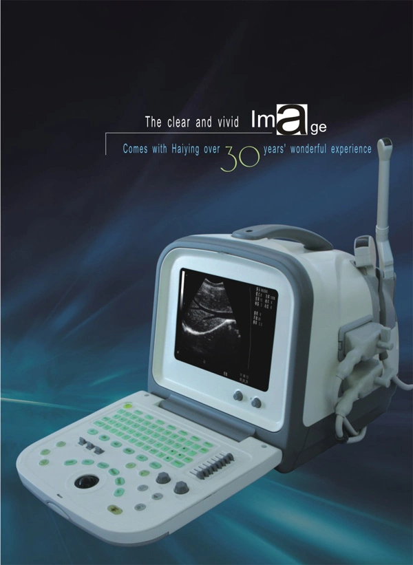 Digital Portable Ultrasound Scanner