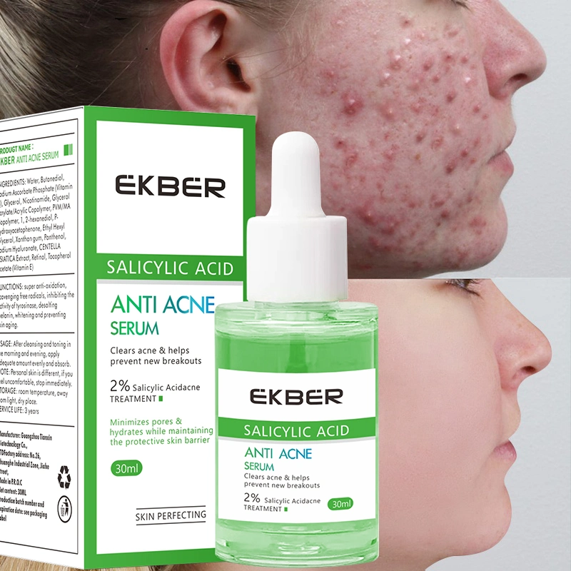 Private Label Organic Gesichtsbehandlung Akne-Spots Clearing Haut Beruhigendes Scar Fading Anti Akne Serum